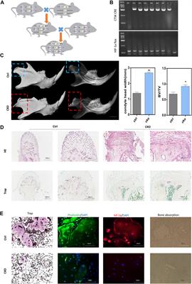 LncRNA-mRNA Expression Profiles of Osteoclast After Conditional Knockout HIF-1α